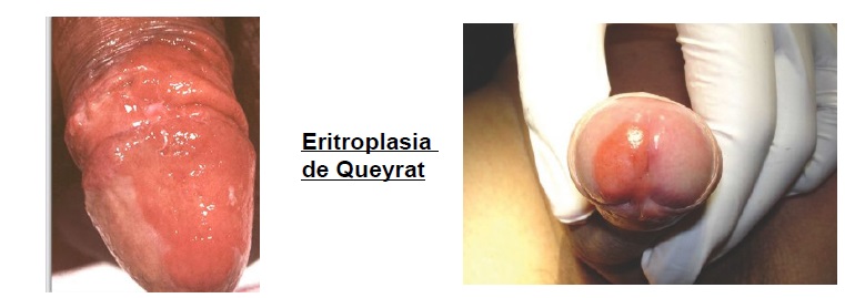 Como llevar a la muchacha del orgasmo si un pequeño miembro